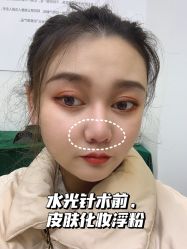 -西安壹加壹医疗美容·西北抗衰旗舰店