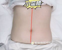 点击看大图 -Lily纤美·科技减脂中心