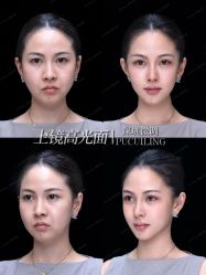 -深圳艺星医疗美容医院