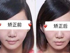 -团圆口腔·种植中心(锦江院区)
