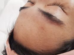 -薇兰专业脱毛连锁机构