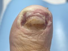 -Andrew指甲专科灰指甲·甲沟炎矫正·3D步态矫形鞋垫定制(上海法华镇路旗舰店)