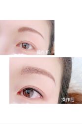点击看大图 -Verywang半永久纹眉•仪器野生眉