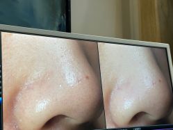 -苑苑vbeauty科技美容SPA