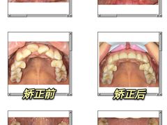 -爱雅仕口腔·数字化矫正中心(国贸门诊)