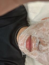 -海涛医疗美容·面部抗衰·注射美鼻