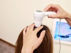 -希梵尔头皮抗衰·科技养发