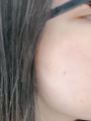 -广州美莱医疗美容医院