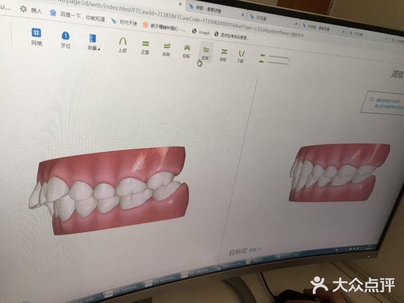 你确定你不想矫牙？