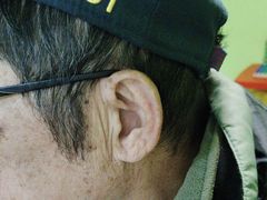 -宁耳听力助听器奥迪康峰力西门子斯达克(静安闸北店)