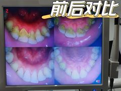 -土豆口腔(凤凰北总店)