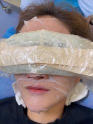 -广州健丽·去眼袋医疗美容机构