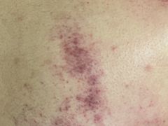 -沈师傅盲人按摩工作室(密三小区店)