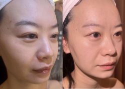 -上海伊莱美医疗美容医院