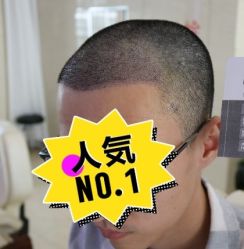 -大麦微针植发丨全国连锁