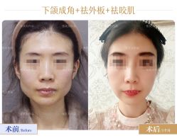 -圣嘉新医疗美容医院