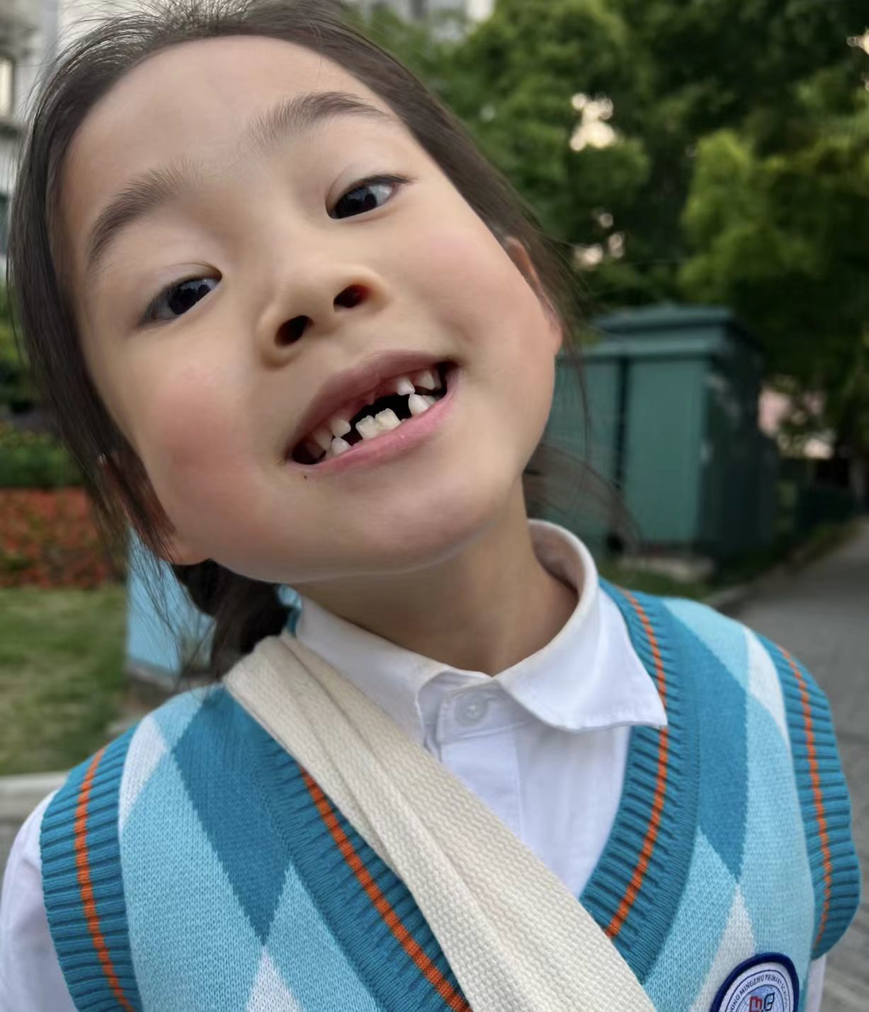 全网笑容最治愈女孩#牙齿保护#口腔医院#儿童牙齿#萌娃#牙齿保护计划