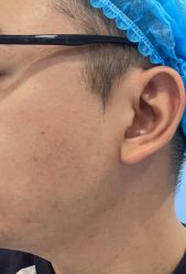 体验前-重庆联合丽格第五医疗美容医院