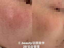 -E.beauty驻颜·痘敏肌调理中心