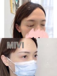 -MIVI半永久纹眉纹绣