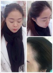 绣上完美的发际线+韩式半永久定妆眉-平萍纹绣韩式半永久定妆