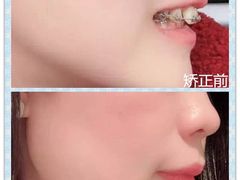 -团圆口腔·种植中心(锦江院区)
