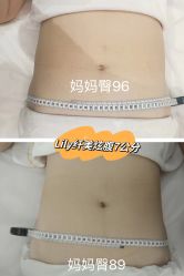 -Lily纤美·科技减脂中心