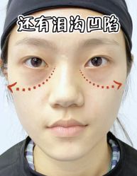 -天津健丽·去眼袋医疗美容机构