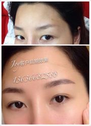 iphone_upload_pic-百秀名媛纹绣美学护肤中心