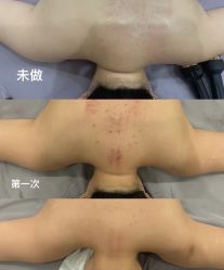 -Lily纤美·科技减脂中心