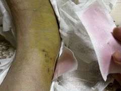 -天津市第三中心医院