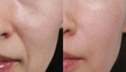 -郡艺医疗美容·微整·眼鼻吸脂