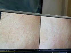 -苑苑vbeauty科技美容SPA