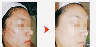 点击看大图 -SKINIST丽铂医疗美容