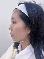 体验后-Yestar艺星医疗美容医院