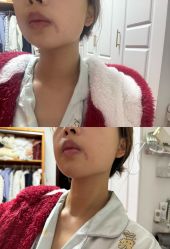 -深圳艺星医疗美容医院