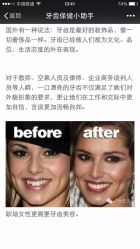 点击看大图 光SPA牙齿美白-光SPA科技美肤