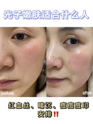 -蚌埠国色医疗美容医院•眼鼻整形