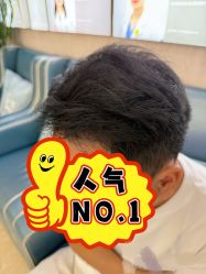 -大麦微针植发全国连锁
