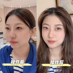 -UP&UP·半永久眉毛眼线机器野生眉