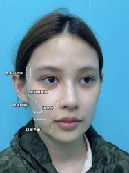 -上海伊莱美医疗美容医院