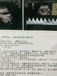 -北京安琪