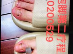 -世龙世家灰指甲·甲沟炎·跖疣护理·修脚(东江湾路店)