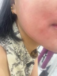 -美瑞莎创美医疗美容