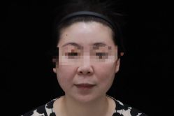-上海漾颜医疗美容