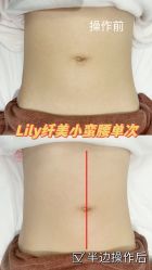 -Lily纤美·科技减脂中心