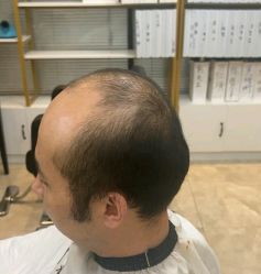 -唐风采假发补发定制