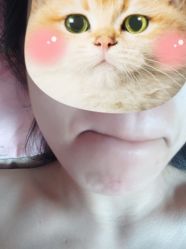 体验后-西安现代妇产医院医疗美容