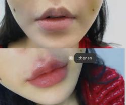 -上海漾颜医疗美容