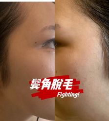 -小梨·OndaPro·专业脱毛连锁机构